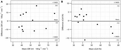 Exercise Training Increases Parietal Lobe Cerebral Blood Flow in Chronic Stroke: An Observational Study
